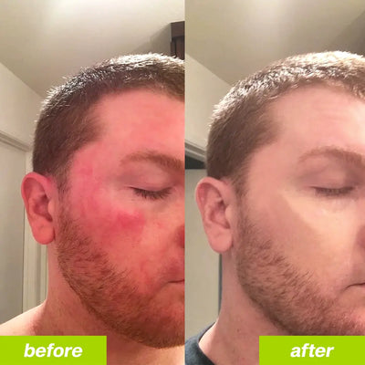 Liver+ Milk Thistle Liver Detox & Colon Cleanse Enerra